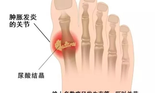 甲钴胺吃了10天脚麻还没好-甲钴胺吃20片有啥副作用网-分享甲钴胺吃多久为宜，甲钴胺吃多长时间要停药知识库